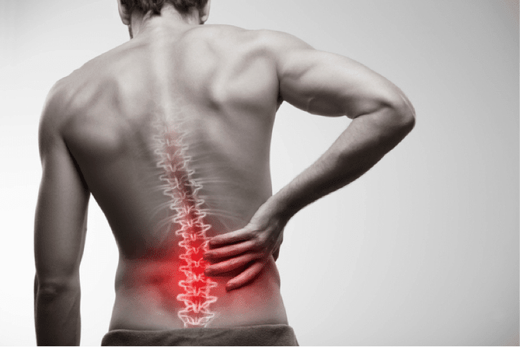 Understanding Lower Back Pain Causes IMPACT Physical Therapy